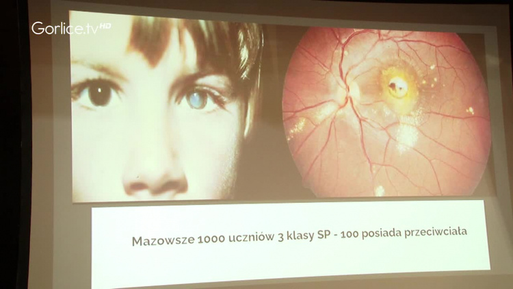 Rozpoczął się Tydzień Profilaktyki Zdrowia w Kromerze